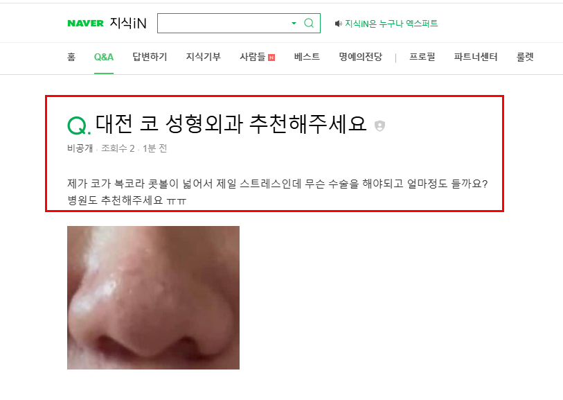 대전 코 성형외과 추천 질문