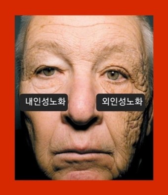 피부 노화