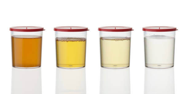 간수치 낮추는법 및 낮춰주는 음식. 간수치가 높으면 다양한 증상들이 나타나는데요. 어떤 증상과 정상 수치는 무엇인지 참고하시기 바랍니다.