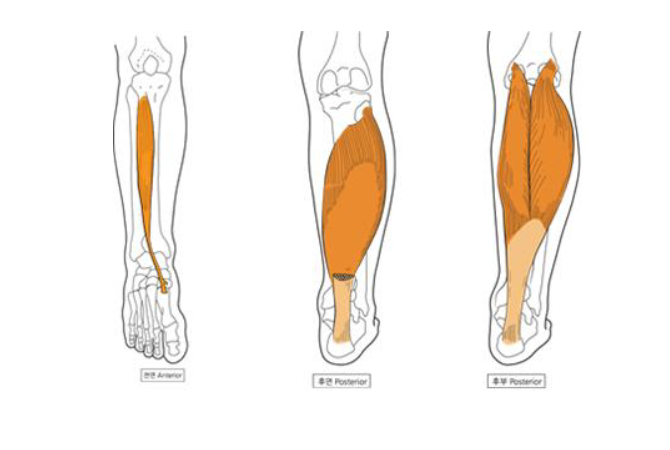 종아리 통증 진단