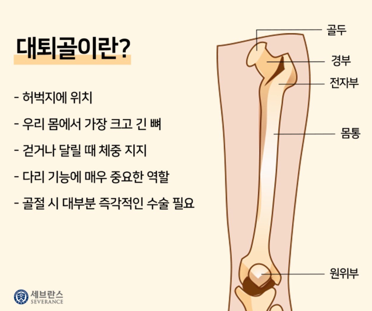 대퇴골이란? - 출처:세브란스병원