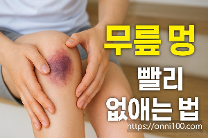 무릎멍빨리없애는법