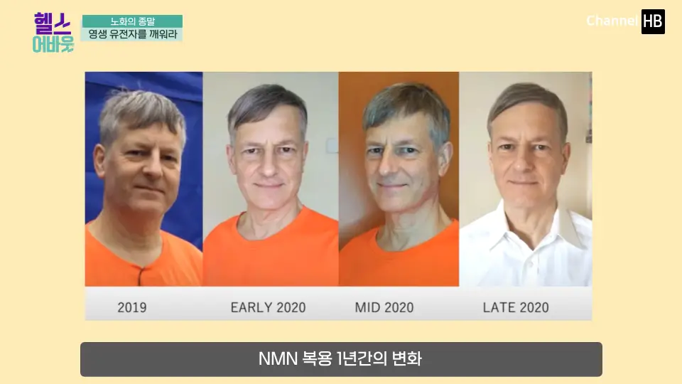 일본NMN36000