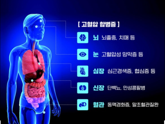 고혈압과 심장 건강 관련 이미지