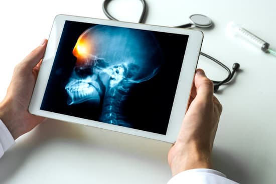 경막외 출혈 제거술 (Epidural Hematoma Evacuation)