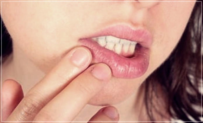 구내염 패치: 가격, 장단점, 사용방법