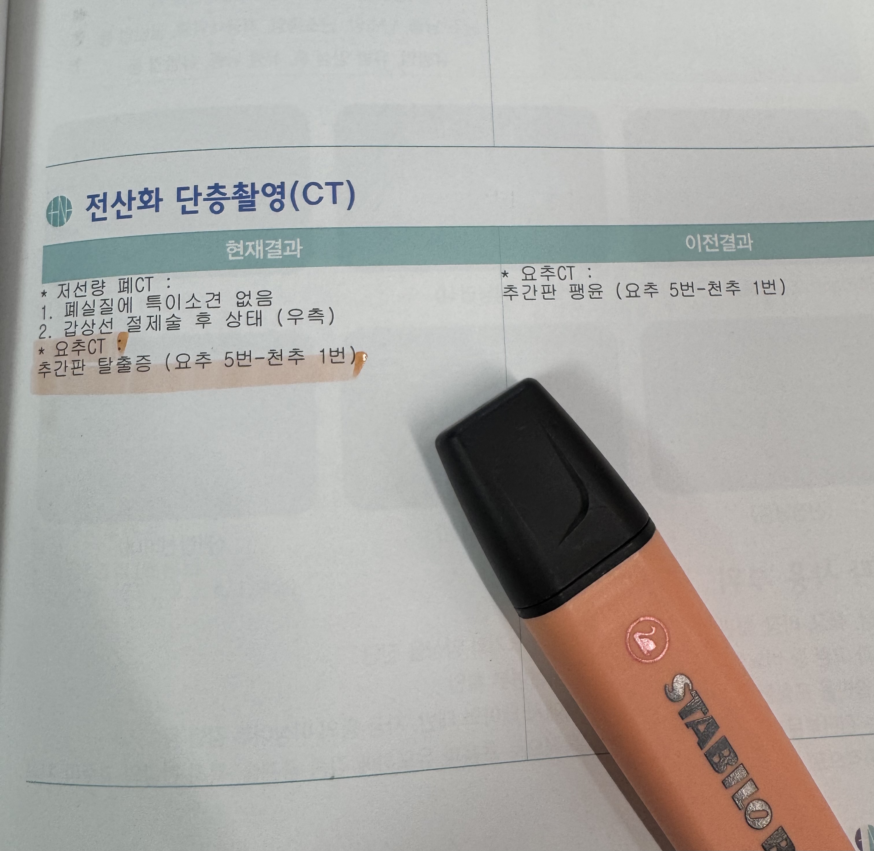 필자가 추간판 탈출증을 진단 받은 상태