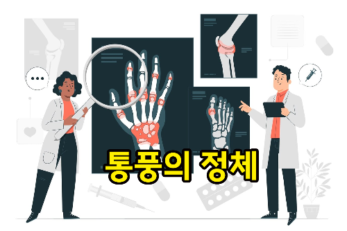통풍