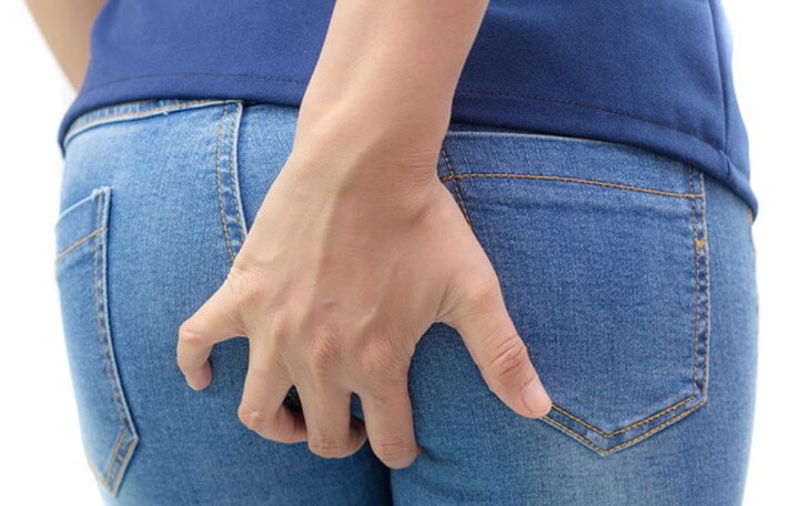 항문 가려움증