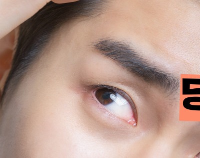 두피 가려움증 원인 치료