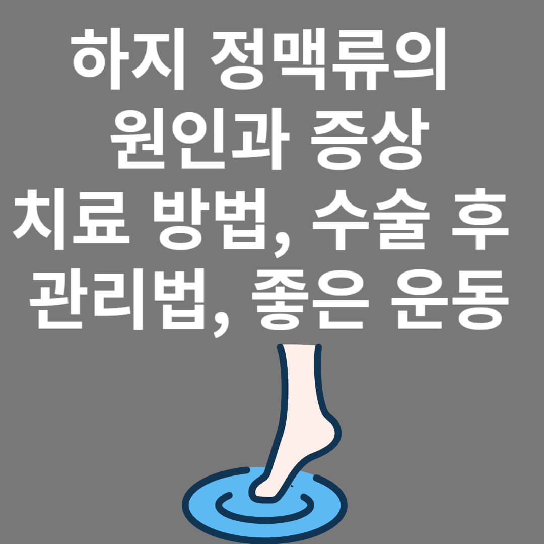 하지정맥류의 원인과 증상&#44; 치료법과 수술 후 관리법&#44; 좋은 운동