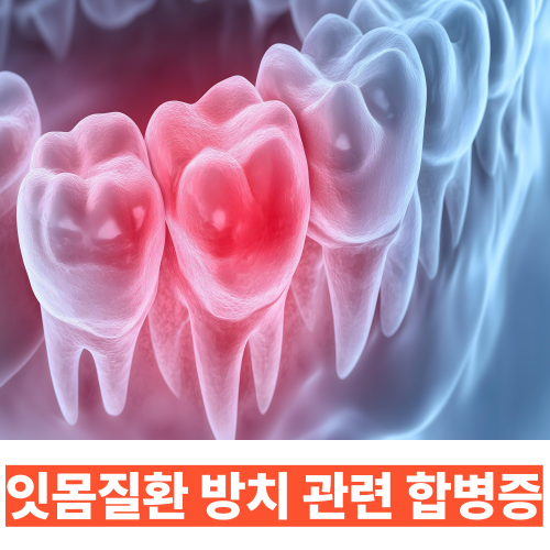 잇몸병 예방