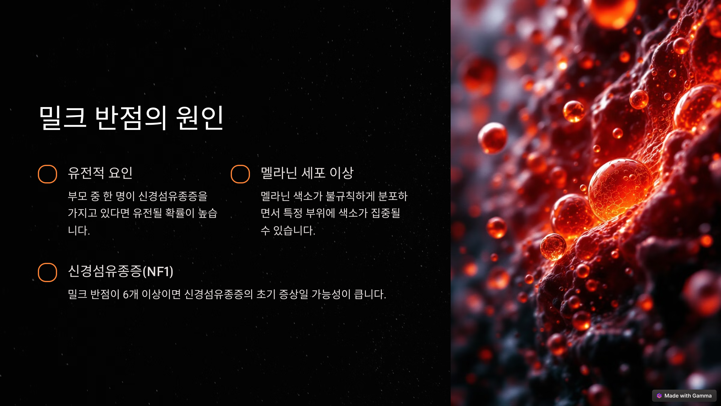 피부에 갑자기 밀크 반점? 신경섬유종 초기 증상 체크!