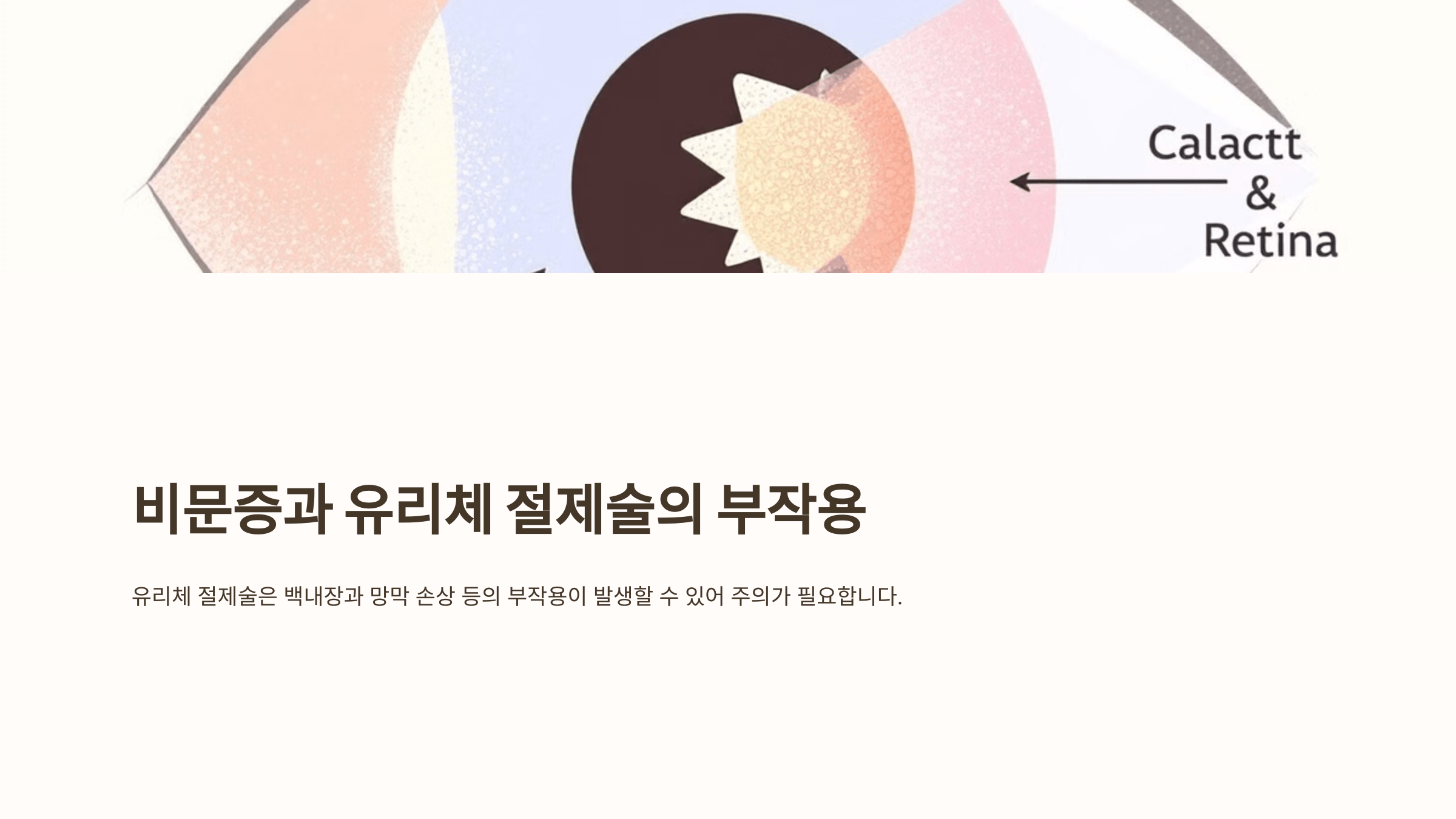 비문증과 관련된 사진입니다.