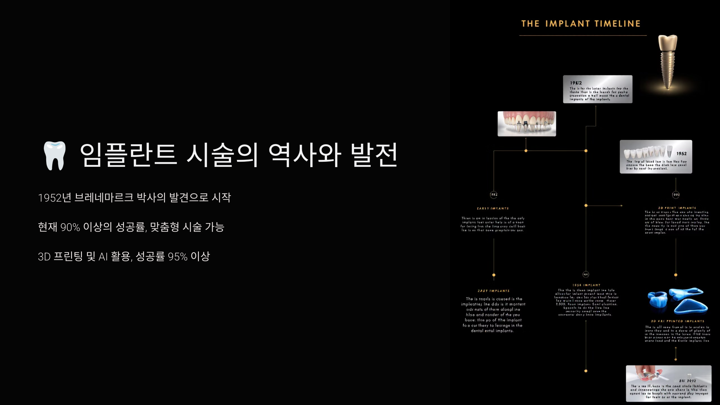 임플란트 시술의 역사와 발전