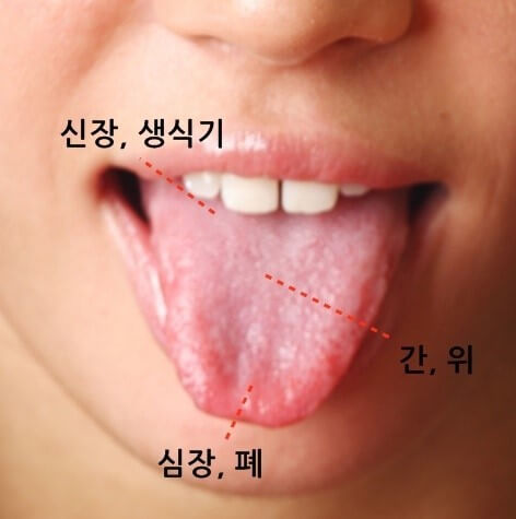 혓바늘 원인 5가지와 없애는 법
