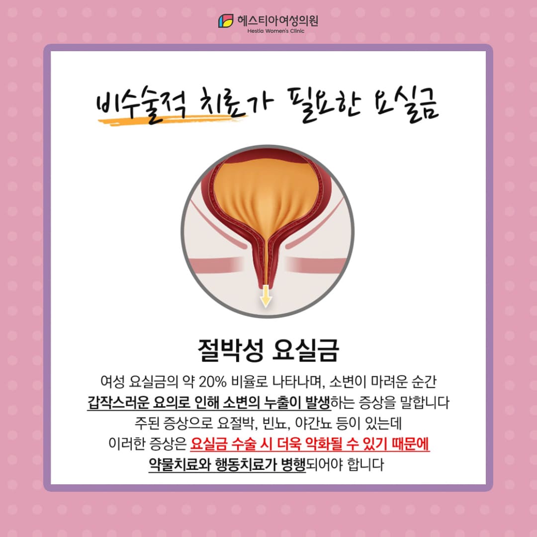 요실금 수술이 필요하지 않은 절박성 요실금