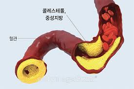 총콜레스테롤 정상수치
