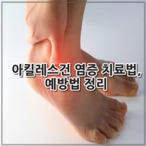 아킬레스건 염증 치료법, 예방법