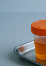 소변 색깔로 보는 건강 &amp;#124; 정상 색&amp;#44; 이상 신호&amp;#44; 병원 방문 기준