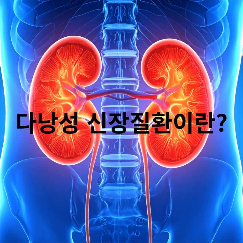 다낭성 신장질환 증상과 다낭성 신장질환 좋은 음식