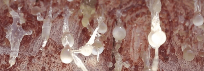 보스웰리아 나무에 맺힌 수액