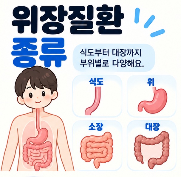 식도 위 소장 대장 아이콘을 중심으로 위장질환 종류 문구를 보여주는 대표 카드뉴스 이미지