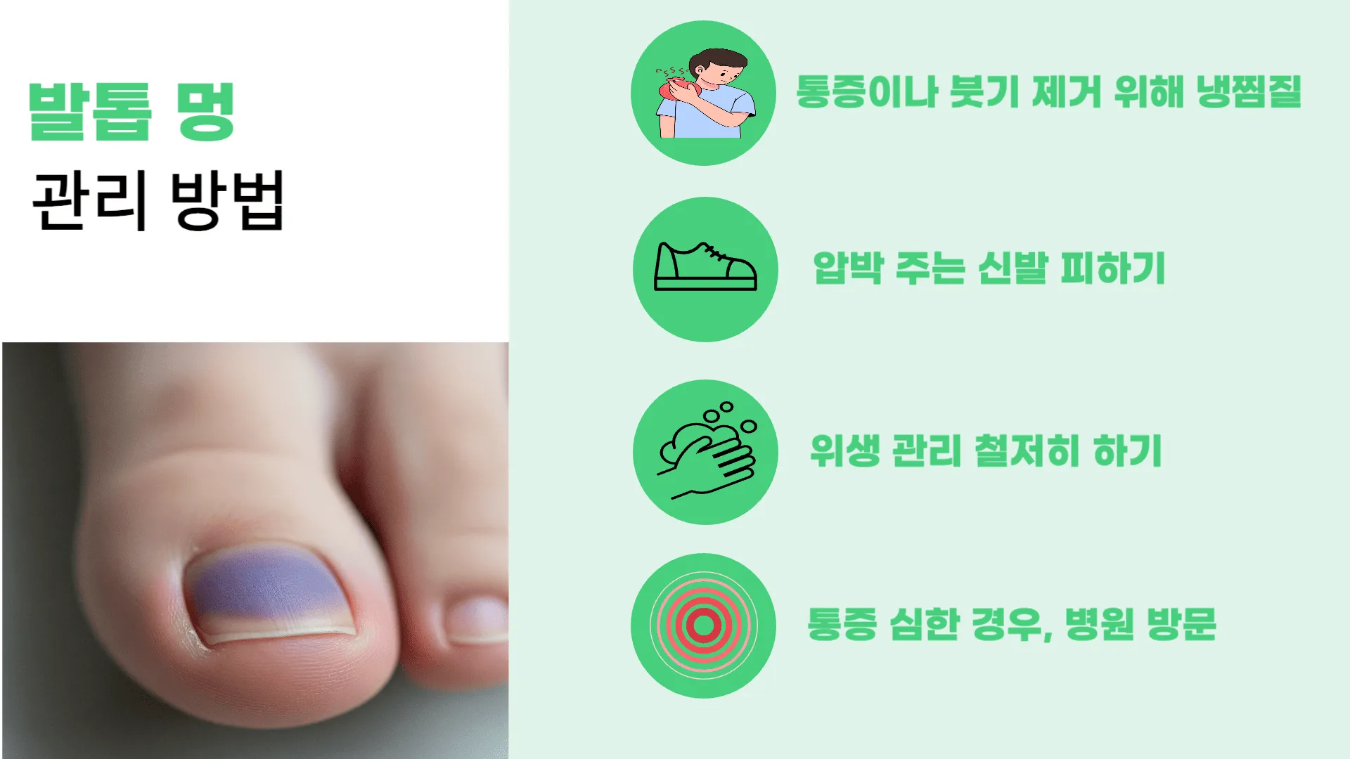 발톱 멍 관리 방법