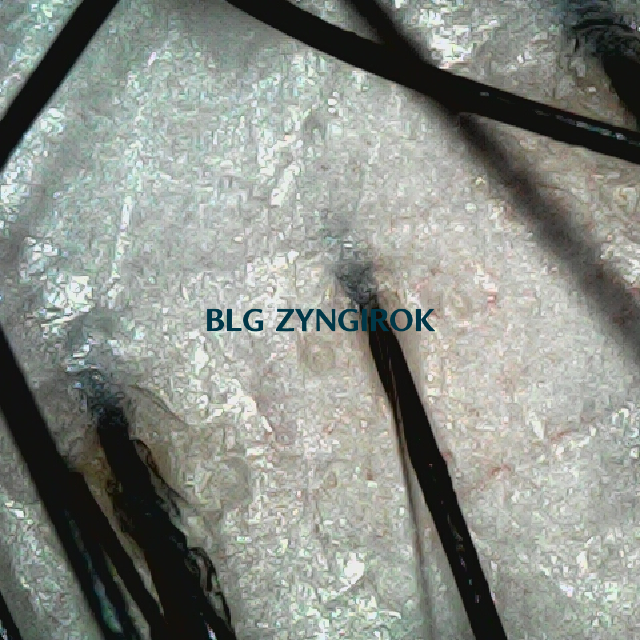 피나모아 복용 14주차 두피 사진 뒷머리 모습이다.