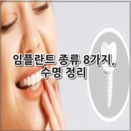 임플란트 종류 8가지, 수명 알아보기