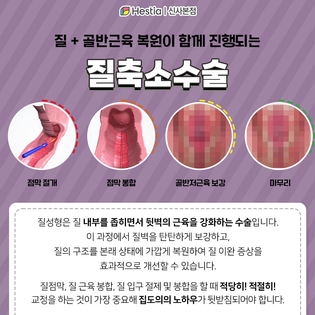 질성형수술이란?