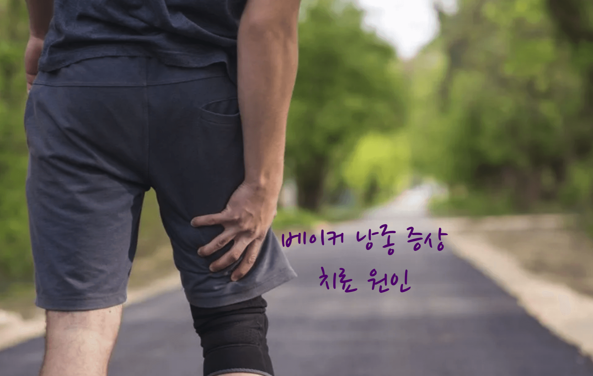 베[이커 낭종 치료