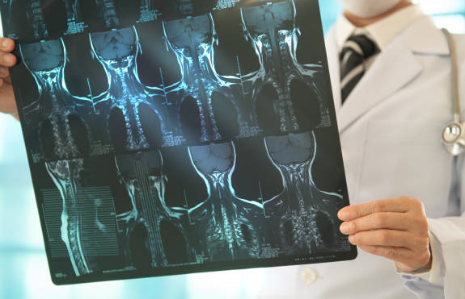 갑상선암 증상&amp;#44; 수술후 회복기간&amp;#44; 수술후 좋은음식 총정리 (2024ver)