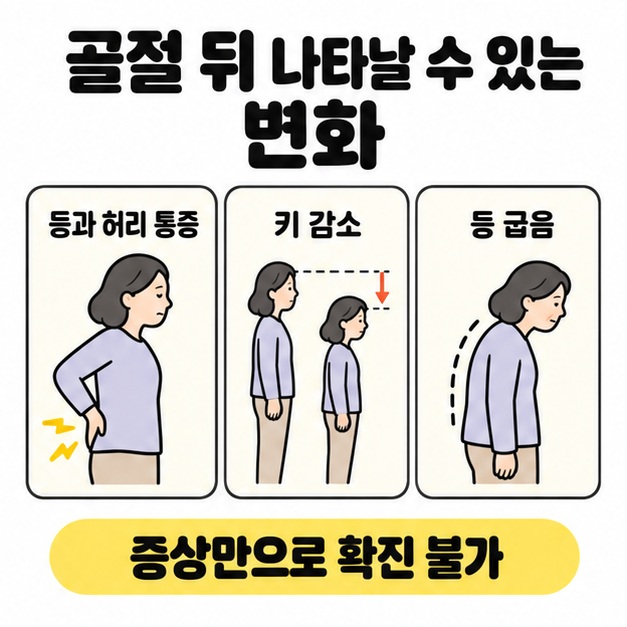 골절 뒤 나타날 수 있는 등과 허리 통증, 키 감소, 등 굽음을 나란히 보여주며 증상만으로 확진할 수 없음을 안내한 그림