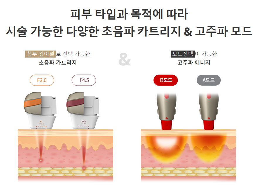 올리지오 효과