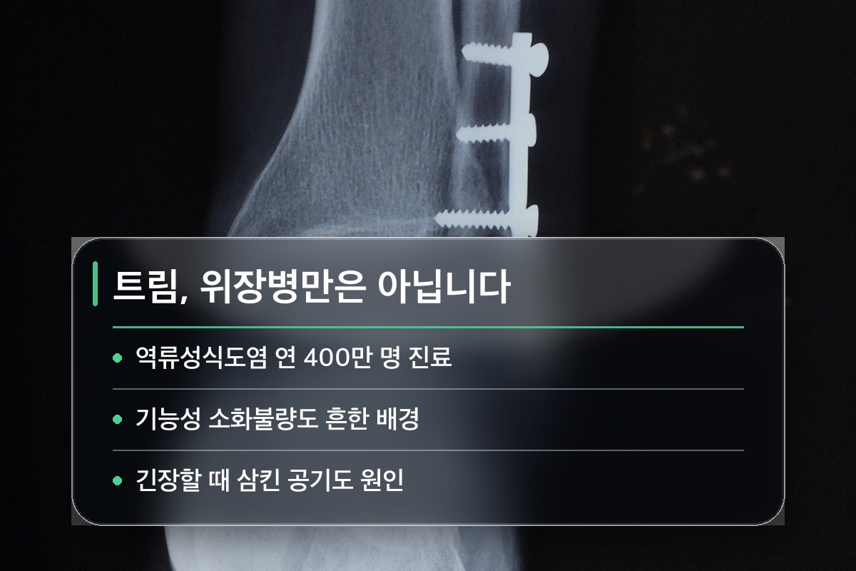 트림 자주 위장병 탓이라는 생각은 절반만 맞습니다