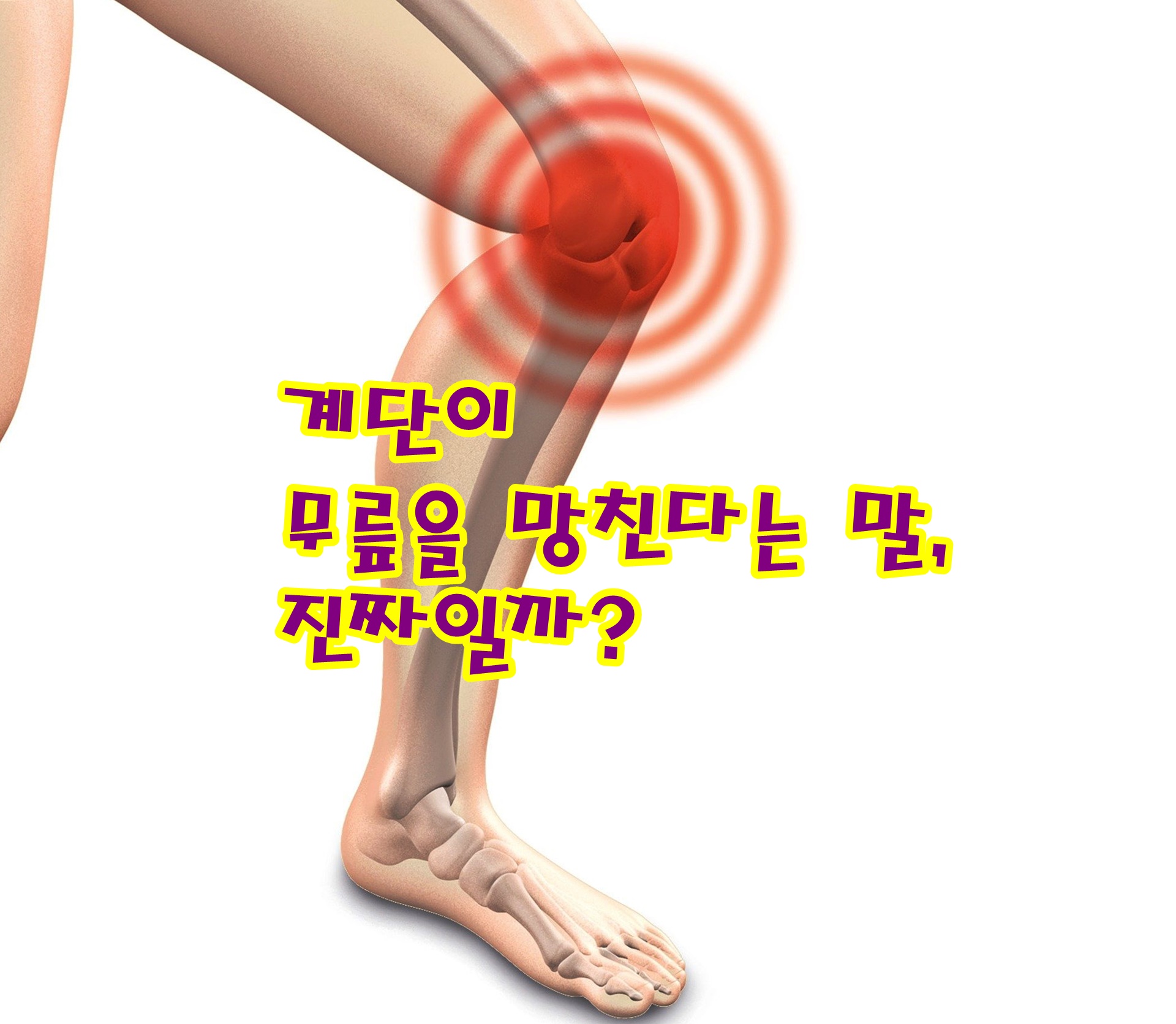 계단이 무릎을 망친다는 말, 진짜일까?