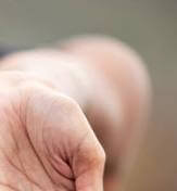 드퀘르벵 증후군, 손목 건초염 증상・원인・치료법