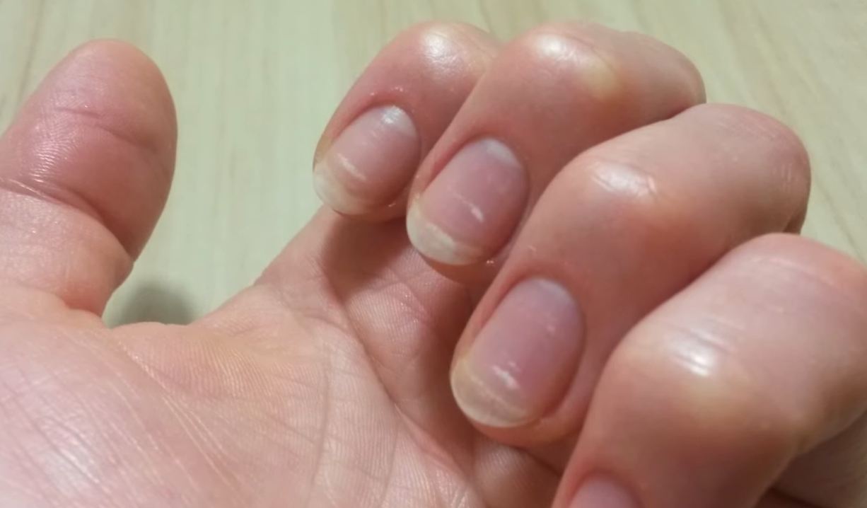 손톱이 잘 부러지는 이유