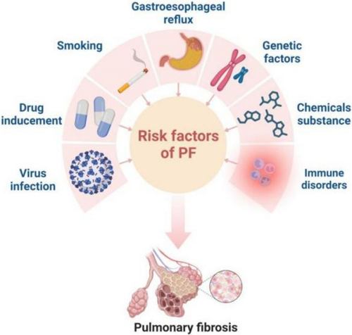 폐섬유화의 주요 원인