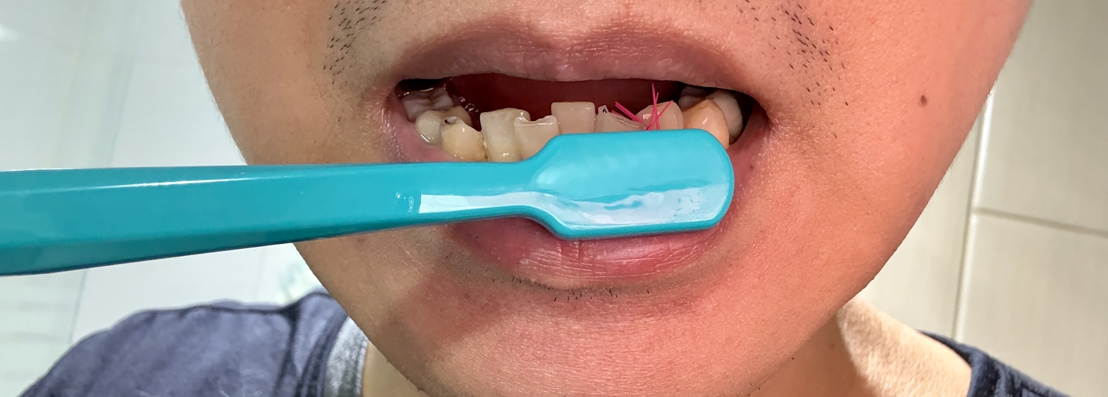 치아와 잇몸 경계부를 닦기