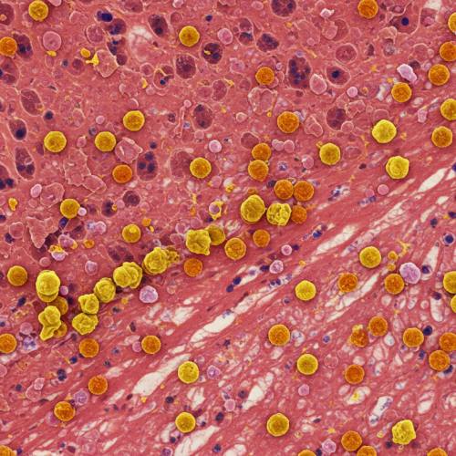 콘드로이친 효능