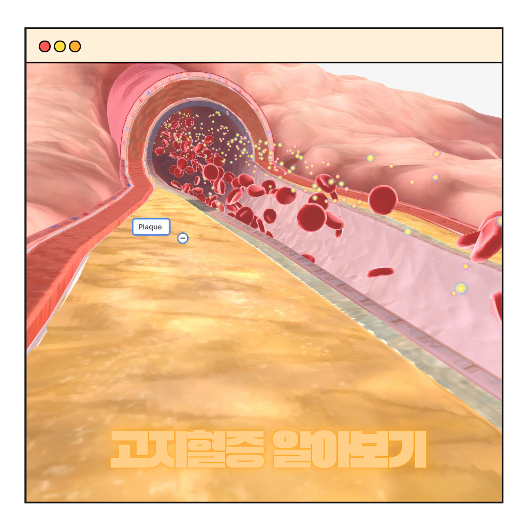 고지혈증 증상 수치 치료법 알아보기
