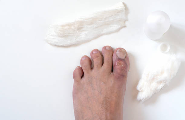 발에-상처가-나고-부은모습