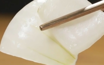 양파장아찌이미지