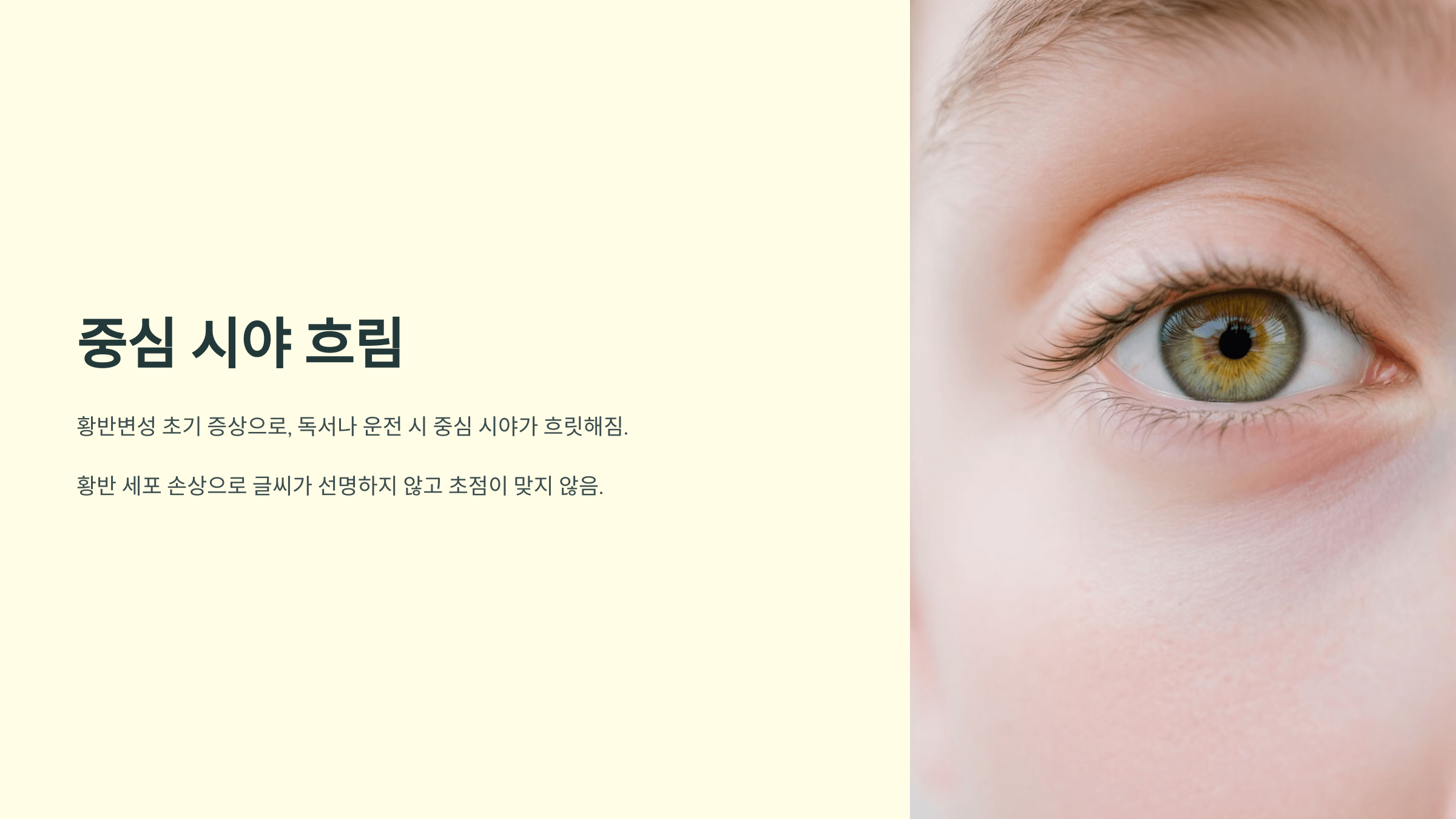 황반변성과 관련된 사진입니다.