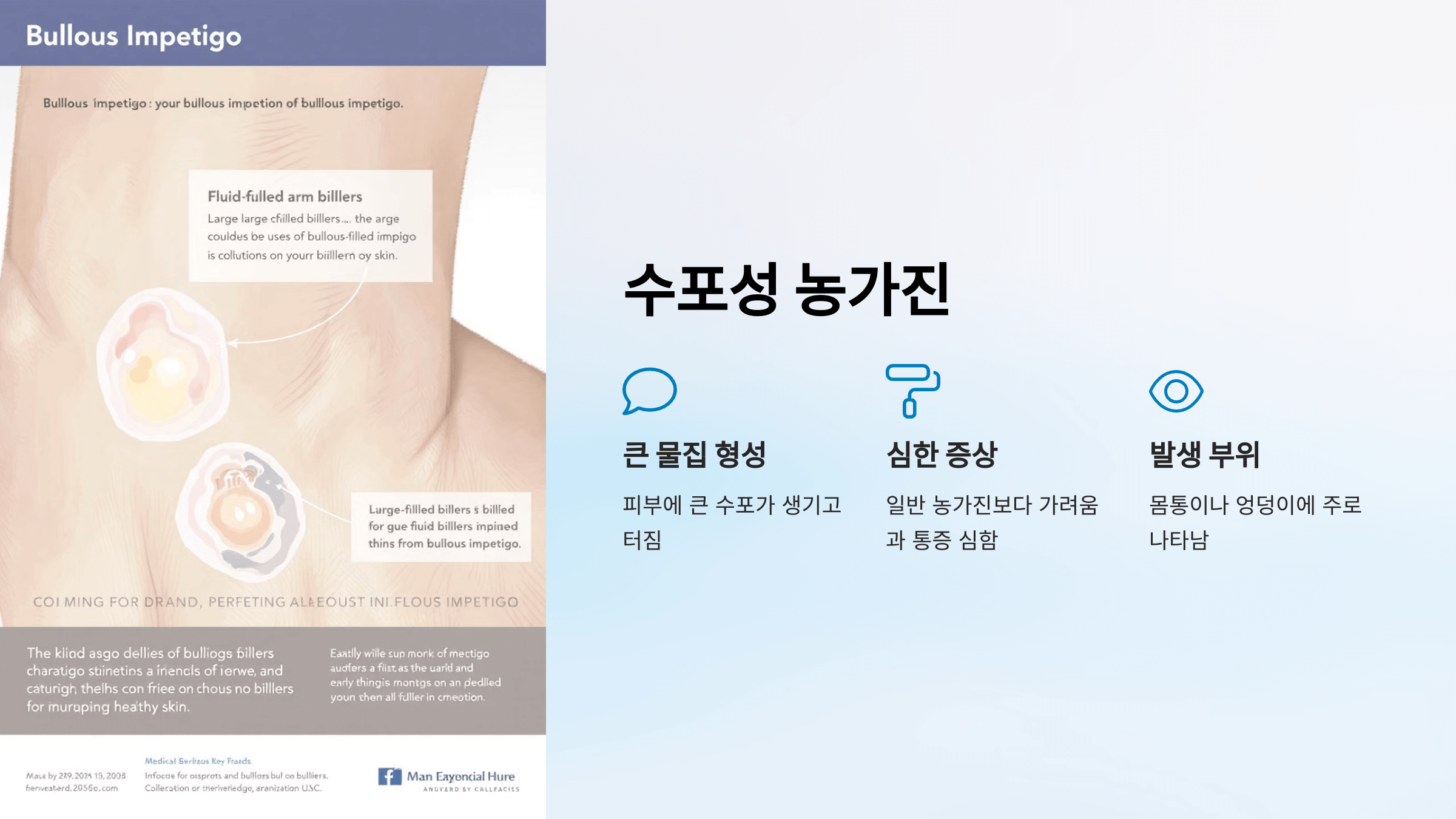 농가진과 관련된 사진입니다.