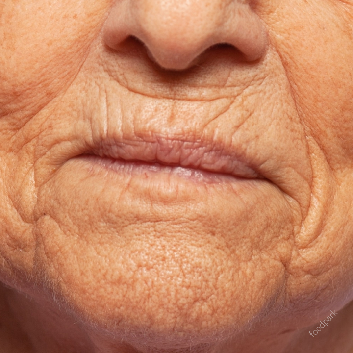 피부 노화 원인