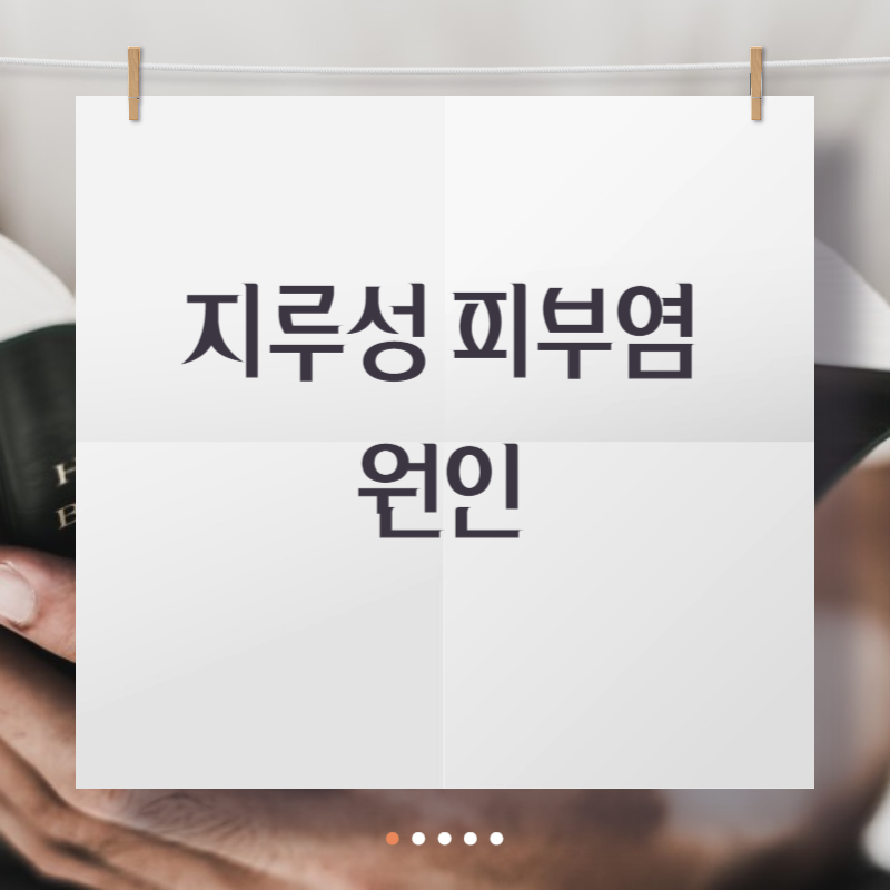 지루성 피부염 원인