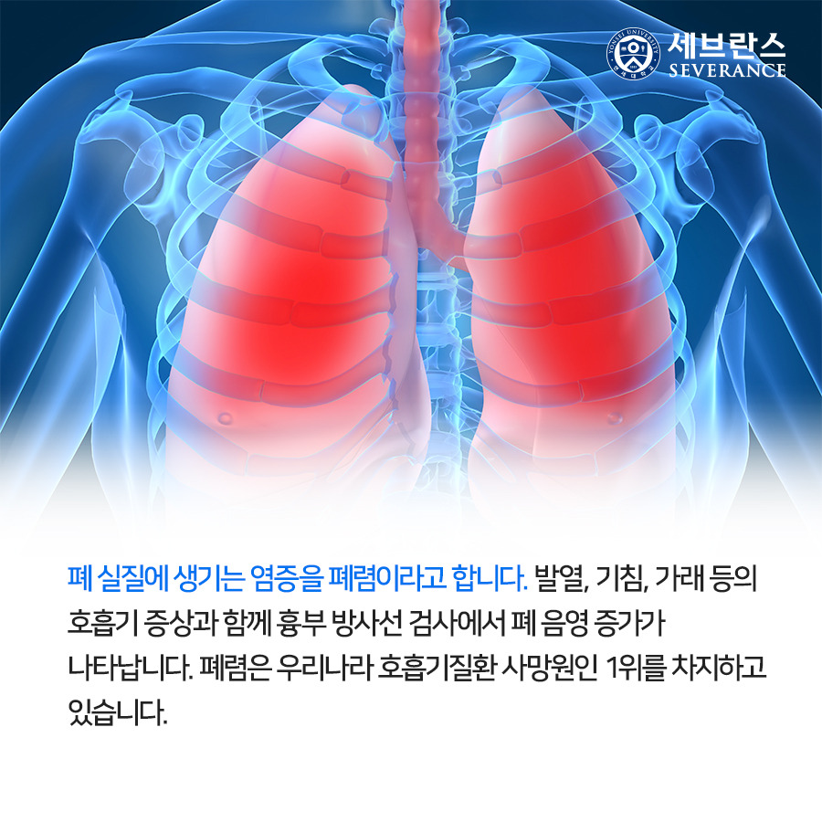 급성폐렴
